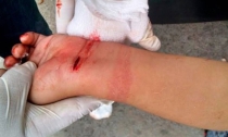 EN GUAYMAS NORTE  Quinceañera intenta quitarse la vida