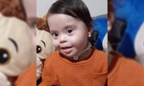 En Guaymas Niño necesita ayuda urgente para operación