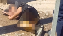 Resulta hombre con quemaduras