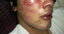 Reportan a cholo por agredir a parroquiano