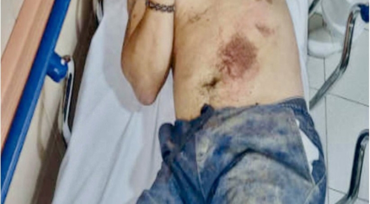 Buscan a agresor