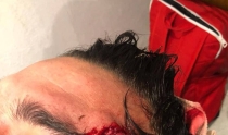 POR GRITARLES CUÑADOS Hermanos agreden a joven