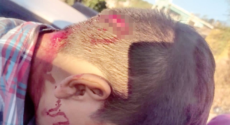 EN EL SECTOR EL RASTRO  Perro de la raza pitbull ataca a niño