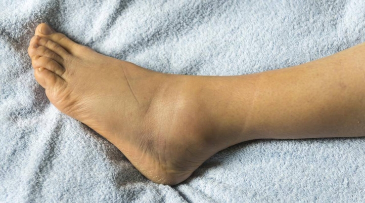 Cae agresor. Por lesionar en tobillo con piedra lo detienen