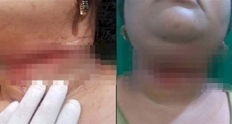 Mujer intenta suicidarse