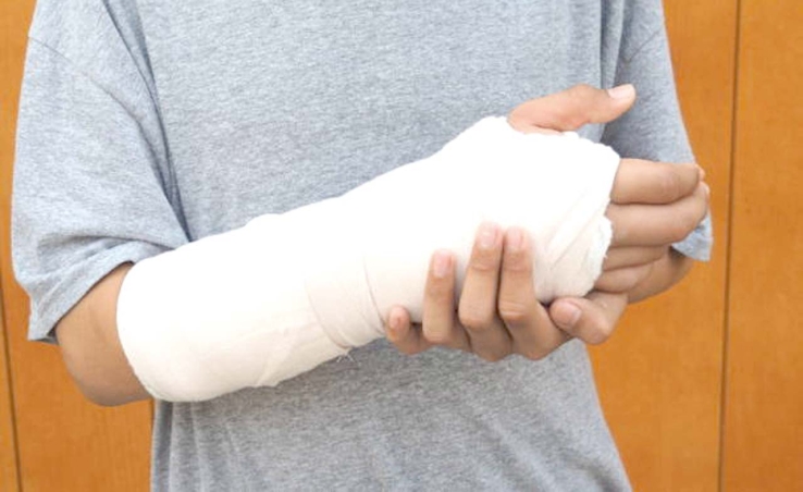 Niño se fractura brazo al caer