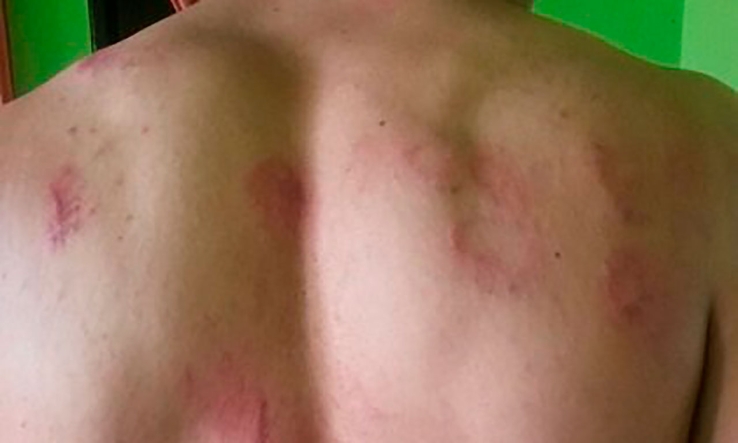    CELOSO HOMBRE   Golpea a compañero de trabajo