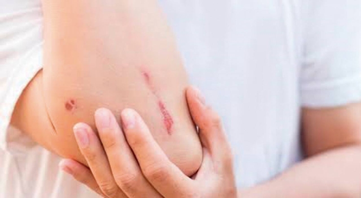 Golpean a vecino