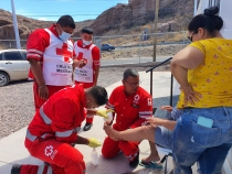 En Miramar atienden a cinco personas por picadura de mantarraya
