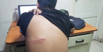 POR LA ESPALDA Apedrea a vecino